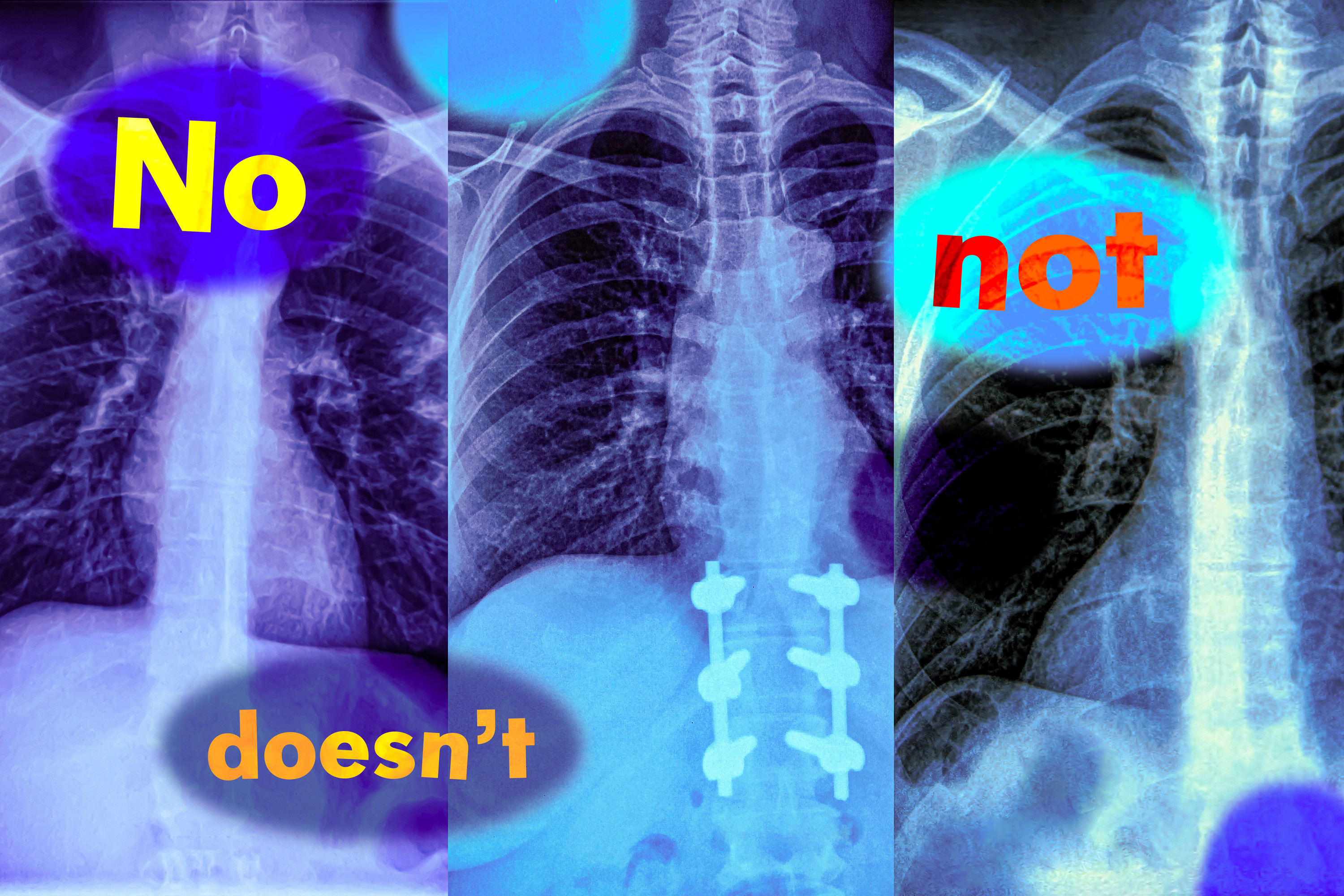 MIT researchers found that vision-language models, which are widely used to analyze medical images to streamline diagnosis,…