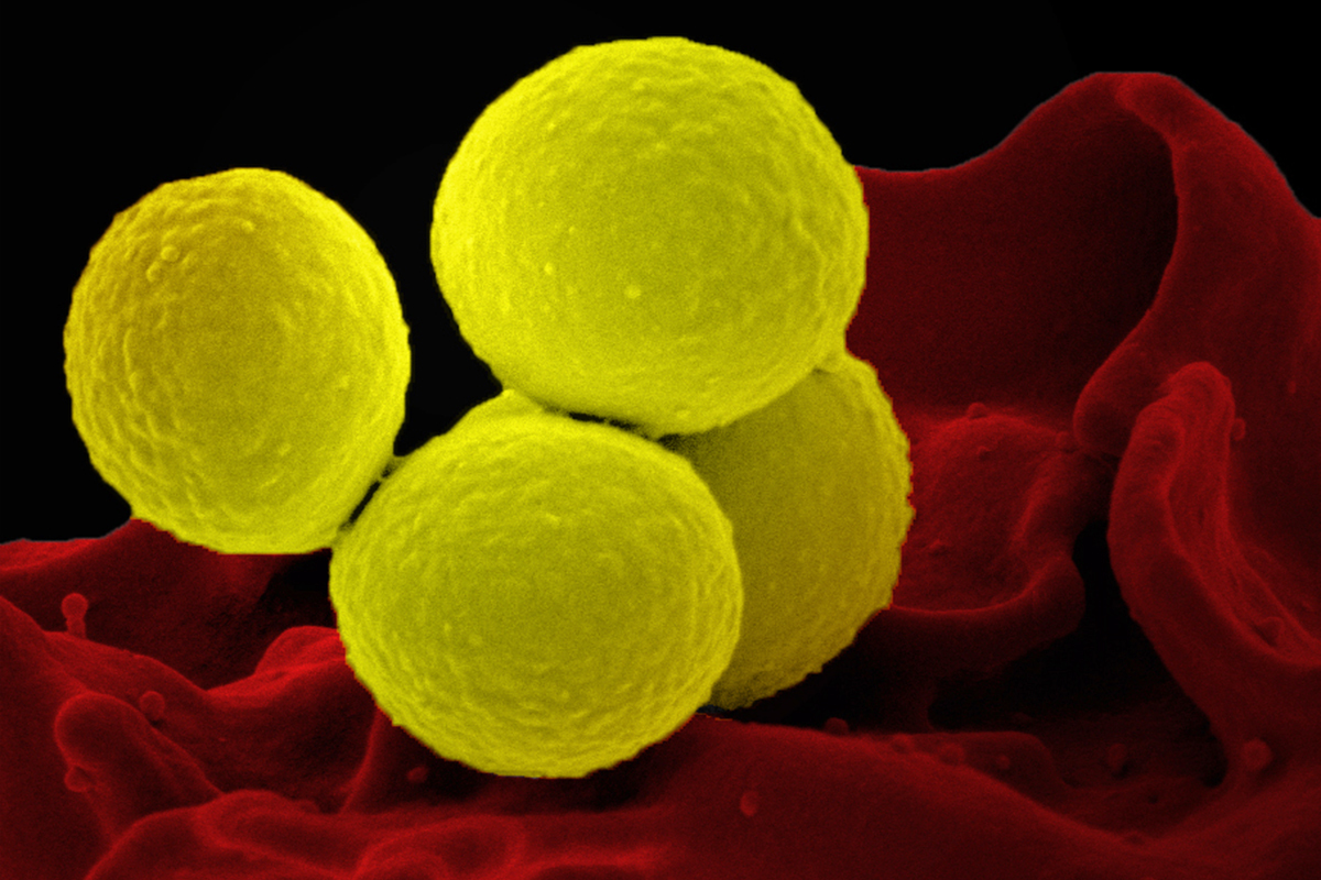 An SEM image showing four yellow-colored, spheroid shaped, Staphylococcus aureus bacteria.