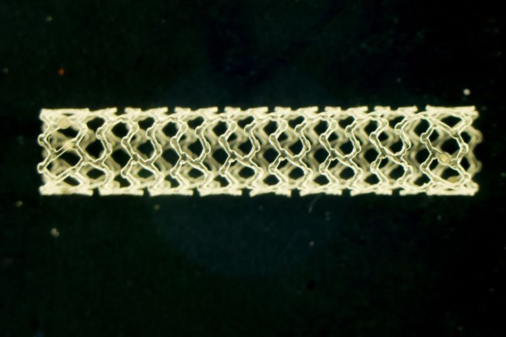 mit-stent-failure-720x480.jpg