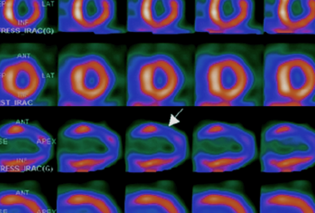 Structural and Functional Imaging