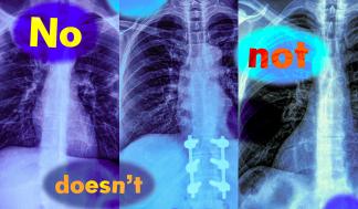 MIT researchers found that vision-language models, which are widely used to analyze medical images to streamline diagnosis,…