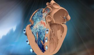 A new bio-robotic model developed by MIT engineers simulates the function of the heart’s lesser-known right ventricle …