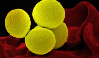 An SEM image showing four yellow-colored, spheroid shaped, Staphylococcus aureus bacteria.