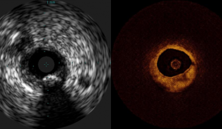 aiimagingstory_realivus_syntheticoct-720x360.png