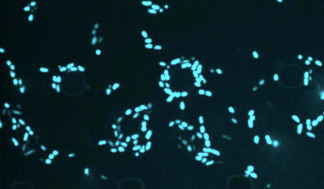 Still from a time-lapse microscopy video of E. coli cells treated with semapimod in the presence of SYTOX Blue.