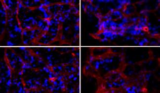mit-bone-marrow-01-press_0-720x479.jpg
