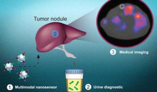 mit-cancer-diagnostic-01-press_0-720x480.jpg
