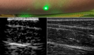 mit-laser-ultrasound_0.jpg