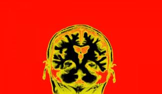 science_mri_758293183-720x480.jpg