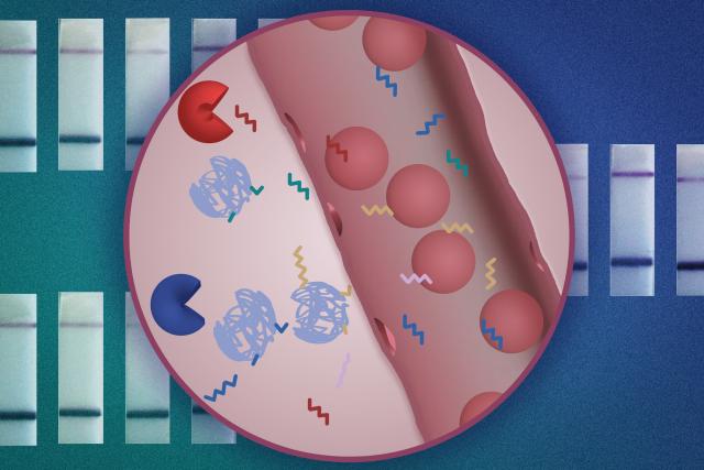 MIT engineers have designed a new nanoparticle sensor that can enable cancer diagnosis with a simple urine test. The…