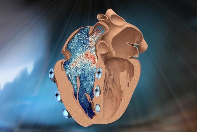 A new bio-robotic model developed by MIT engineers simulates the function of the heart’s lesser-known right ventricle …