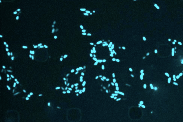 Still from a time-lapse microscopy video of E. coli cells treated with semapimod in the presence of SYTOX Blue.