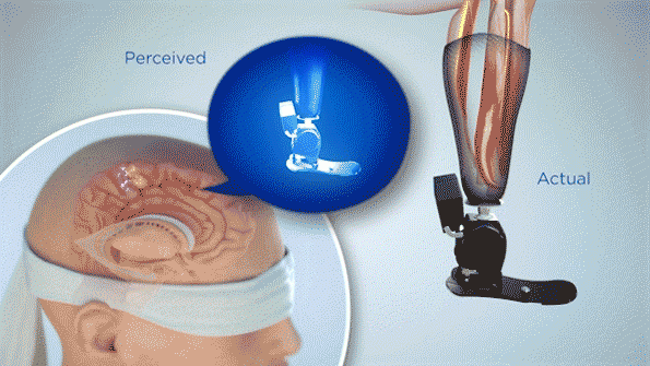 bionic-surgery-2.gif