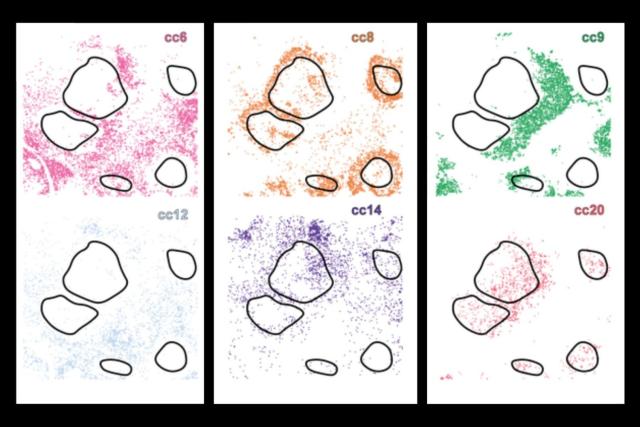 In this view of cHL (classic Hodgkin Lymphoma) tissue, CellLENS identified subtle but distinct CD4 T cell subpopulations…