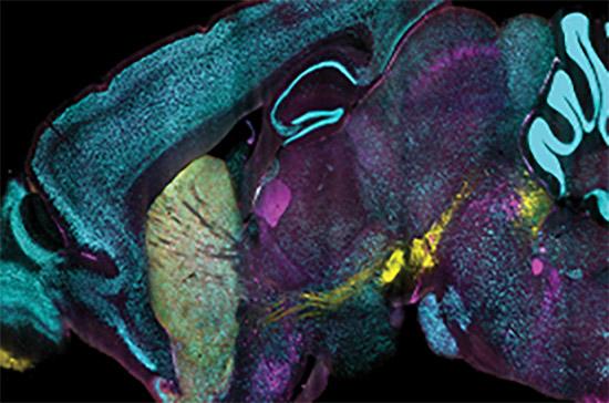 MIT Medical Imaging Initiative